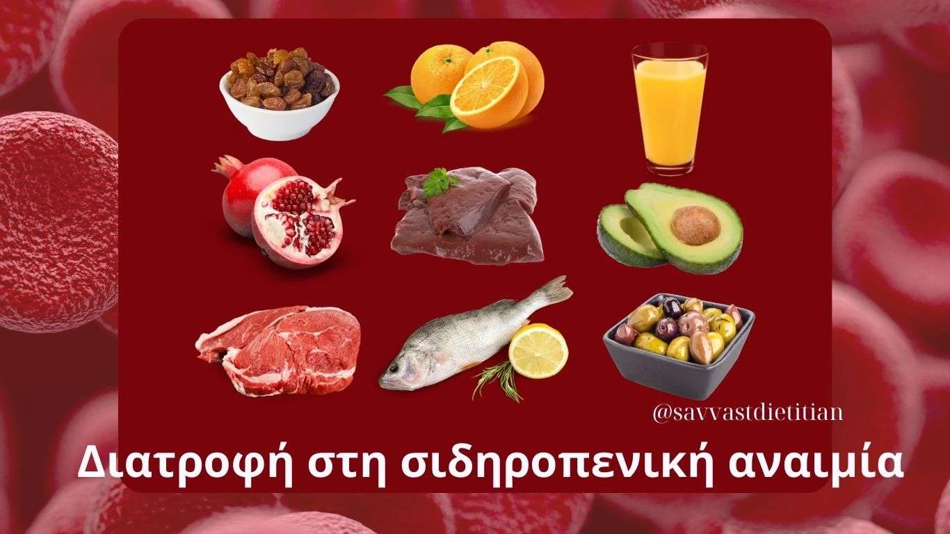 ΔΙατροφή στη σιδηροπενική αναιμία1 σίδηρος σιδηροπενική αναιμία διατροφή τροφές